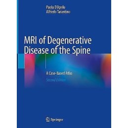 MRI of Degenerative Disease of the Spine - 9783030737061